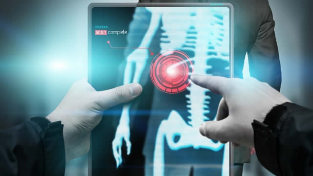 Life Science Tools Maker Revvity Delivers Strong Q1 Earnings Despite Evolving Macroeconomic Backdrop