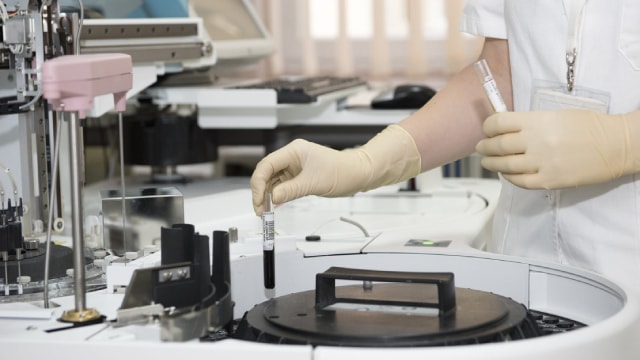 Dren Bio to collaborate with Sanofi to develop autoimmune disease therapies for up to $1.7 billion